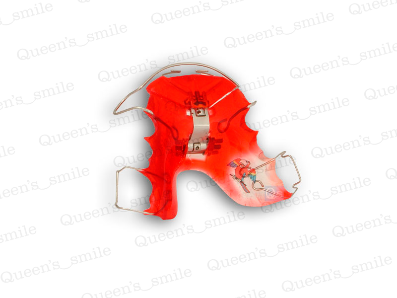 Smiler R43 Galerie - Queens smile