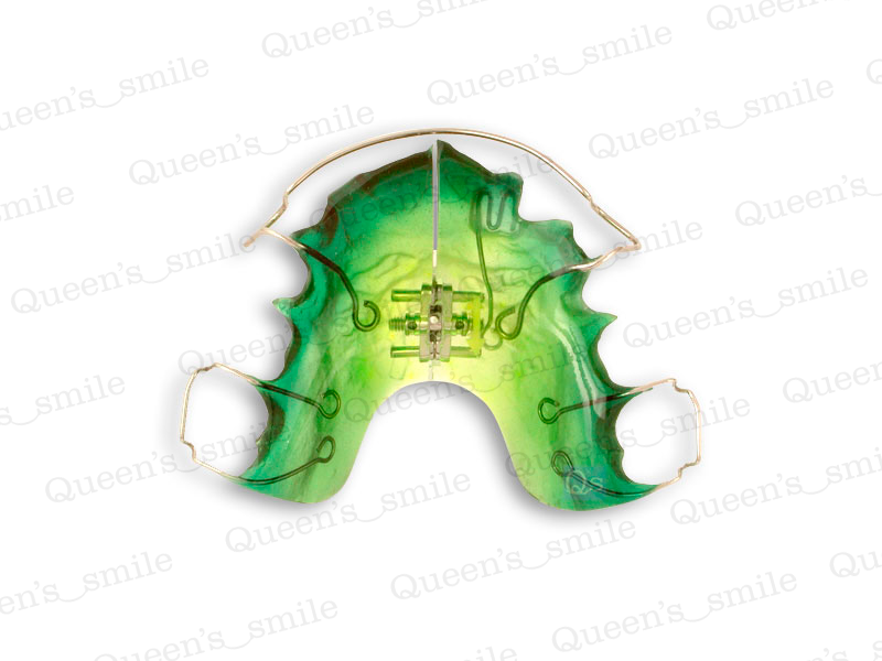 Smiler R43 Galerie - Queens smile