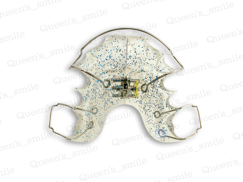 Smiler R43 3D scanner - Queens smile