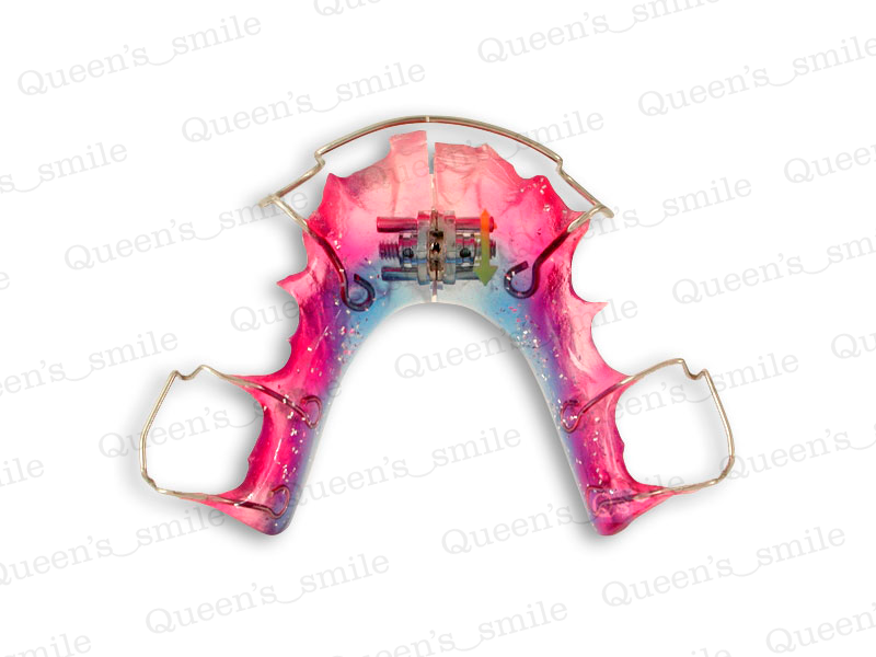 Smiler R43 Galerie - Queens smile