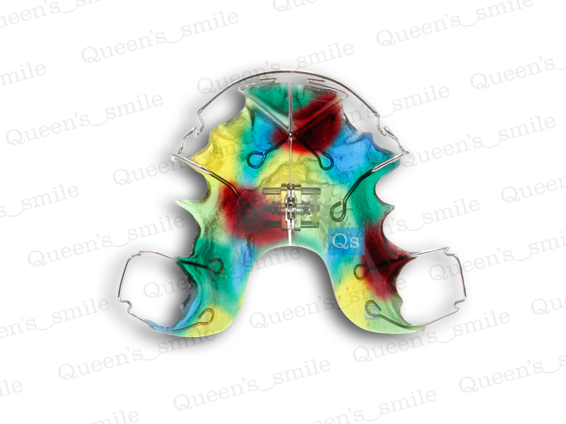 Smiler R43 Galerie - Queens smile