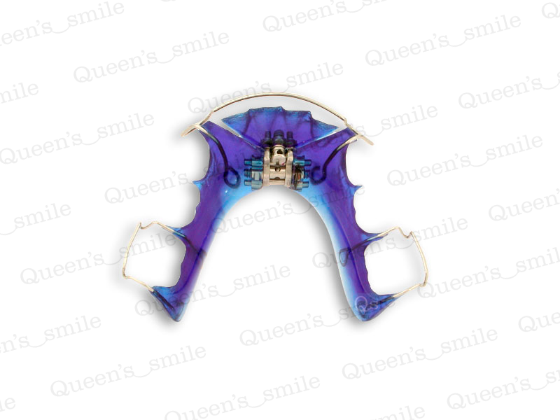 Smiler R43 Galerie - Queens smile