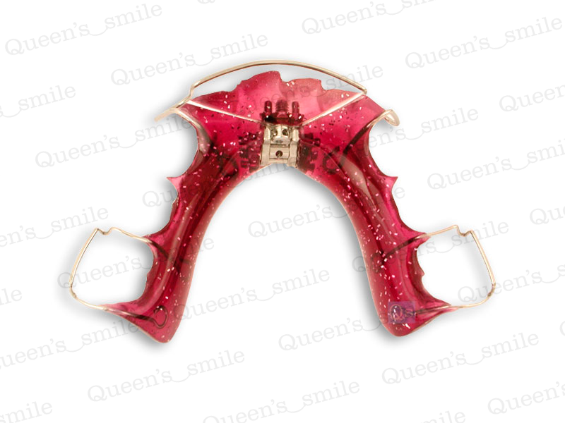 Smiler R43 Galerie - Queens smile