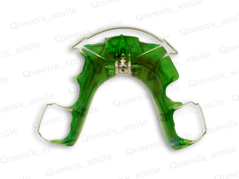 Smiler R43 Galerie - Queens smile