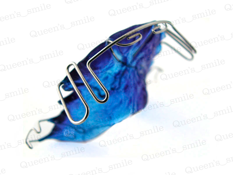 Smiler R43 Galerie - Queens smile