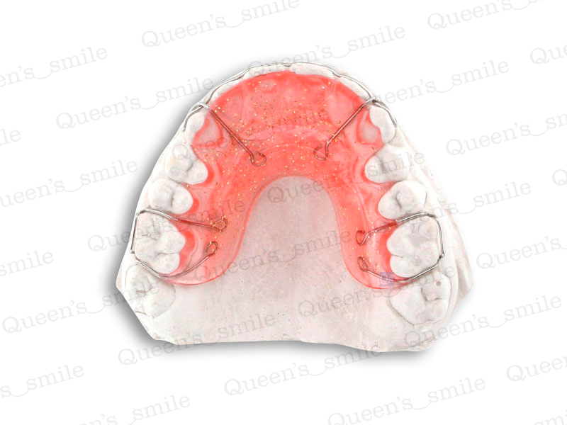 Smiler R43 Galerie - Queens smile