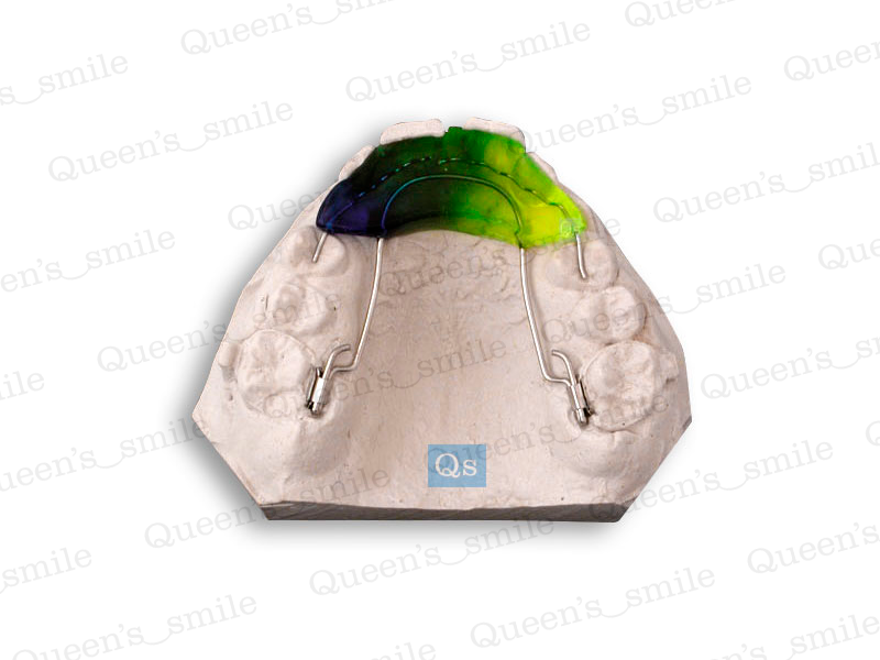 Smiler R43 Galerie - Queens smile