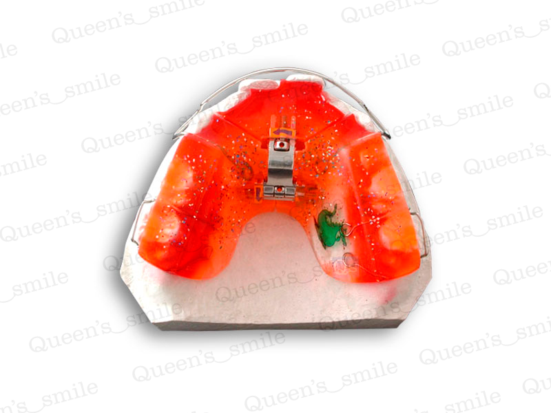 Smiler R43 Galerie - Queens smile