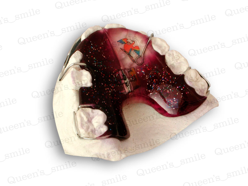 Smiler R43 Galerie - Queens smile