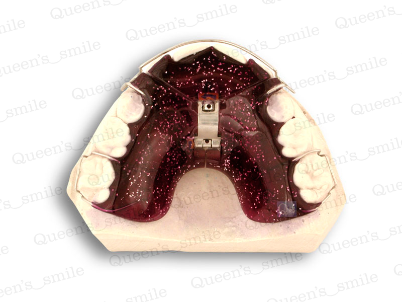 Smiler R43 Galerie - Queens smile