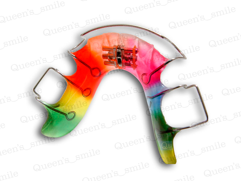 Smiler R43 Galerie - Queens smile